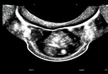 Как проводится ультразвуковое исследование в гинекологии и какие инструменты используются